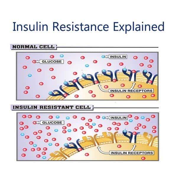 Insulin Resistance – Silent but SERIOUS and making you Obese!