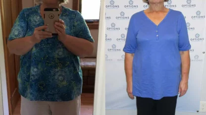 Side-by-side photos of a woman before and after weight loss; on the left, she wears a blue patterned shirt and beige shorts, and on the right, she wears a light blue shirt and black shorts, looking noticeably slimmer.