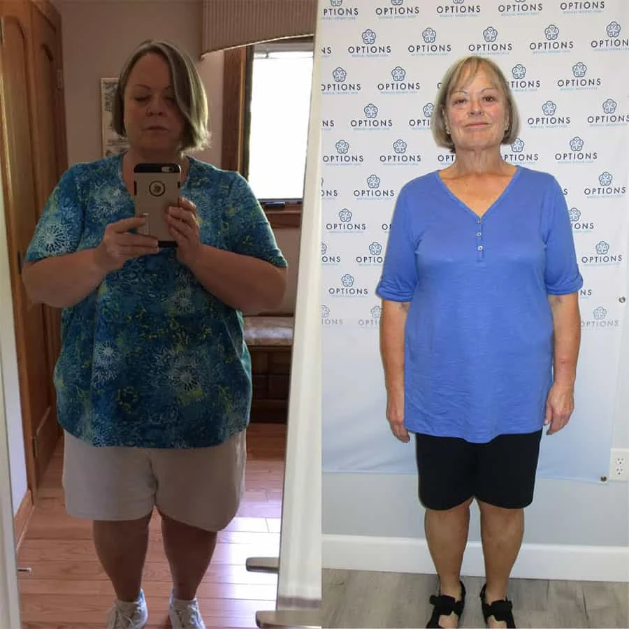 Side-by-side photos of a woman before and after weight loss; on the left, she wears a blue patterned shirt and beige shorts, and on the right, she wears a light blue shirt and black shorts, looking noticeably slimmer.