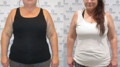 Two side-by-side photos of the same woman in front of a branded backdrop, showing a physical transformation with noticeable weight loss.