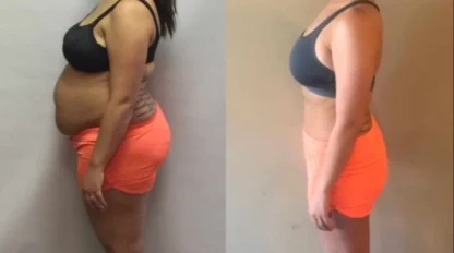 Side-by-side comparison of a woman before and after weight loss, wearing the same workout outfit, standing in profile.