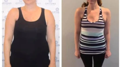 Woman standing for before-and-after photos; left image shows her in a black tank top, right image shows her in a striped top with a slimmer appearance.