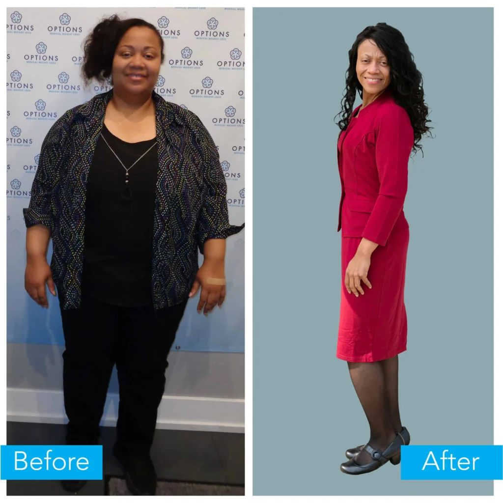 Josephine's before and after.